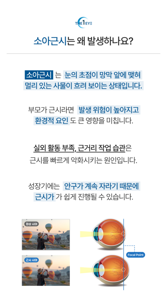 소아근시